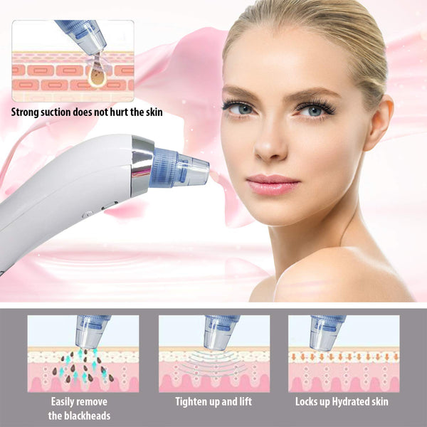 Blackhead Remover Electronic Facial Pore Cleaner Acne Vacuum Remover